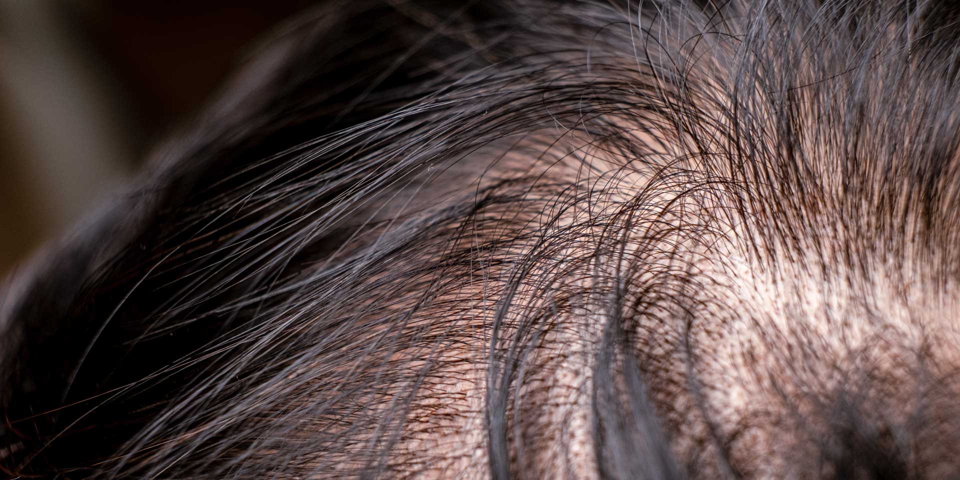 Hair Condition
